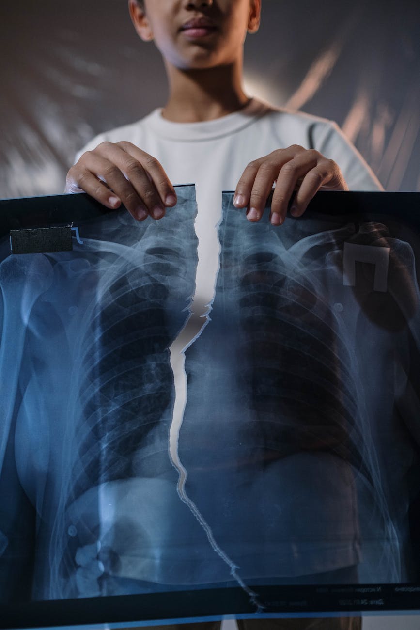 boy holding an x ray picture torn in half